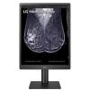 LG 21HQ613D 21.3-inch 5MP 1100nit IPS Diagnostic Monitor for Mammography