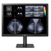 LG 31HN713D 31" 12MP 1200nit Diagnostic Monitor LG 31HN713D 31" 12MP 1200nit Diagnostic Monitor