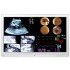 LG 32HL714S 31.5" 4K Surgical Monitor LG 32HL714S 31.5" 4K Surgical Monitor