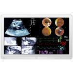 LG 32HL714S 31.5" 4K Surgical Monitor